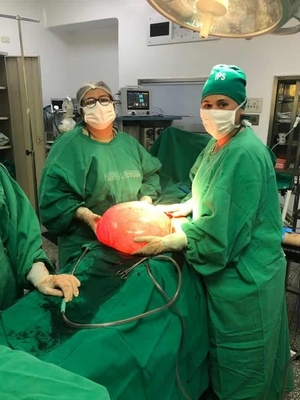 Con total éxito fue extraído durante una cesárea un quiste ovárico con más de 8 kilos 