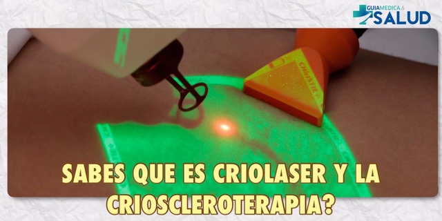 ¿Sabes qué es CRIOLASER Y LA CRIOSCLEROTERAPIA? - DR. CESAR VERA CRISTALDO 