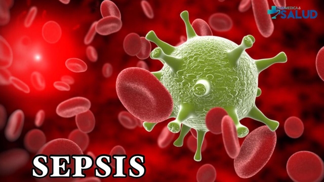 SEPSIS - DRA. ZULMI EVELYN ARANDA SCARPELLINI