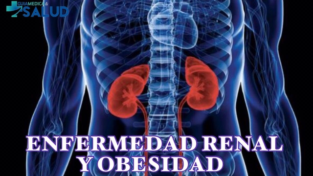 ENFERMEDAD RENAL Y OBESIDAD “UNA VIDA SANA PARA TENER RIÑONES SANOS” - DR. NELSON FERREIRA 