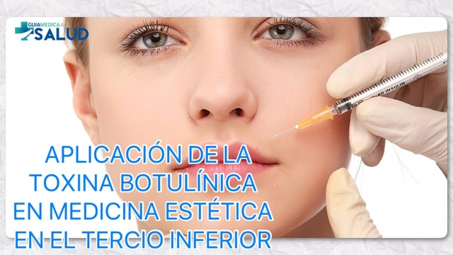 APLICACIÓN DE LA TOXINA BOTULÍNICA EN MEDICINA ESTÉTICA EN EL TERCIO INFERIOR - Dra. Laura Fabiola Quevedo Medina